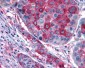 GPR108 Antibody (Cytoplasmic Domain)