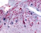 GRM6 / MGLUR6 Antibody (N-Terminus)