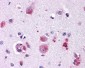 FZD9 / Frizzled 9 Antibody (N-Terminus)