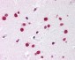 NR5A1 / SF1 Antibody (Ligand-binding Domain)