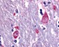 CHRM3 / M3 Antibody (Cytoplasmic Domain)