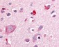 RORB / ROR Beta Antibody (Hinge Domain)