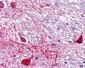 RORA / ROR Alpha Antibody (Ligand-binding Domain)