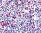 ADGRE3 / EMR3 Antibody (N-Terminus)