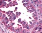 CALCRL  / CGRP Receptor Antibody (N-Terminus)