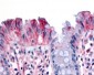 MST1R / RON Antibody (Internal)