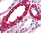 TNIK Antibody (Internal)