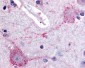 PACE4 / PCSK6 Antibody (Internal)