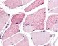 WNK1 Antibody (C-Terminus)