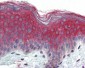 ITGA3 / CD49c Antibody (N-Terminus)