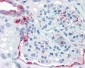 SLC39A14 / ZIP14 Antibody (Internal)