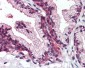 SLC39A14 / ZIP14 Antibody (Cytoplasmic Domain)