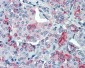 SLC11A2 / DMT1 Antibody (Internal)