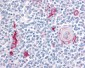 ITGA4  /  VLA-4 / CD49d Antibody (C-Terminus)