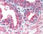 ERBB2 / HER2 Antibody (N-Terminus)