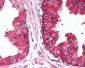 CD38 Antibody (Internal)