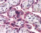 SLC5A6 / SMVT Antibody (Internal)