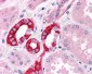 GM2A Antibody (Internal)