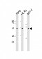 AVPR1A Antibody (C-term)