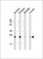 RAB3B Antibody