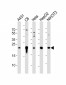 PEBP (Phosphatidylethanolamine Binding Protein) Antibody