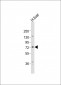 PCCA Antibody (Center)