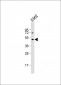 DRD2 Antibody (C-term)