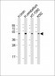 DRD2 Antibody (C-term)