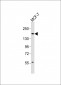 INSRR Antibody (Center)