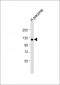 ITGA2B(Integrin alpha-IIb heavy chain) Antibody (C-term)