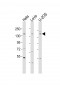 CASR Antibody (C-term)