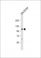 ATP1A3 Antibody (Center)