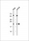 PSMB6 Antibody (Center)