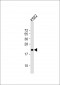 FEV Antibody (N-Term)