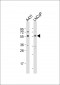 SUFU Antibody (C-term)