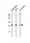 Zebrafish ak2 Antibody (N-term)