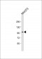 Mouse Ptk7 Antibody (C-term)