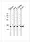 TST Antibody (Center)