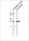 CELA2B Antibody (Center)
