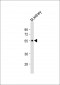 CYP27B1 Antibody (C-term)