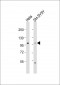 ADCY5 Antibody (Center)