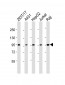 SLC22A2 Antibody (N-term)