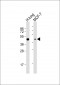 AGER Antibody (Center)