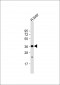 GRHPR Antibody (N-term)