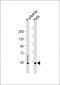 CFI (light chain) Antibody (C-term)