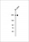 MYH11 Antibody (N-Term)