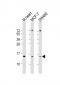 NDUFA7 Antibody (C-Term)