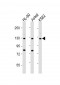 ATP2A3 Antibody (N-Term)