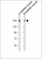 MYH8 Antibody (N-Term)