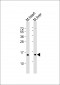 NDUFA7 Antibody (N-Term)